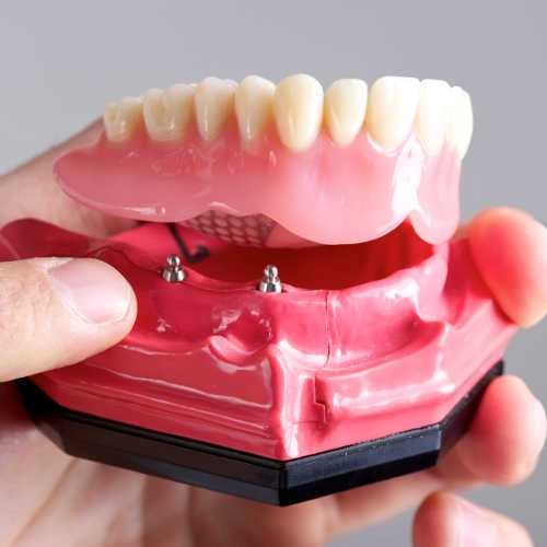 Partial Dentures For Back 
      Teeth Ratliff City OK 73481
